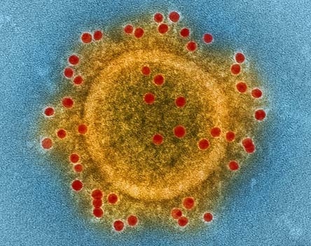 BloombergNEF expects a slowdown of the global solar, battery and e-vehicle market due to the coronavirus outbreak. - © Encyclopaedia Britannica
